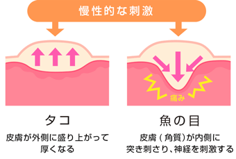 たこと魚の目のイラスト